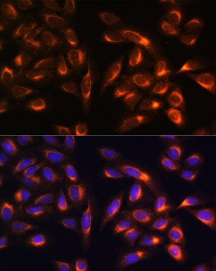 Polyclonal Rabbit anti-Human PTCD1 Antibody (IF)