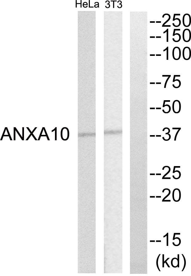Polyclonal Rabbit anti-Human ANXA10 / Annexin A10 Antibody (WB)