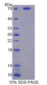 Mouse PROZ / Protein Z (Recombinant His-GST)