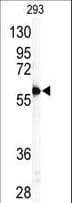 MMP11 Antibody (aa398-426)