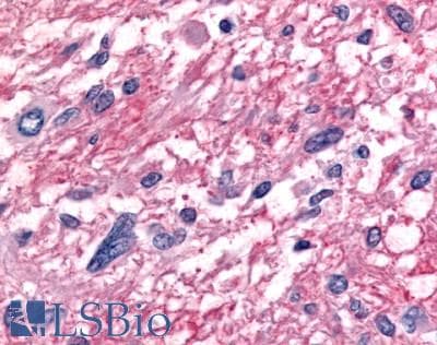PathPlus™ RORB / ROR Beta Antibody (Hinge Domain)