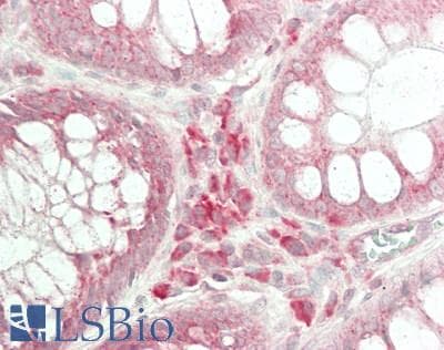 IHC-plus™ TRAF4 Antibody (aa253-302)