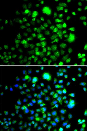 PEX14 Antibody