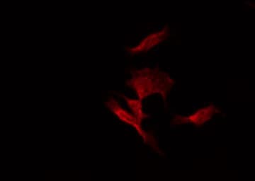 Polyclonal Rabbit anti-Human CHP2 Antibody (IF, WB)