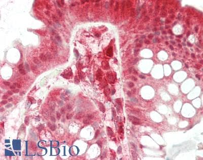 IHC-plus™ TIGAR Antibody (aa25-75)