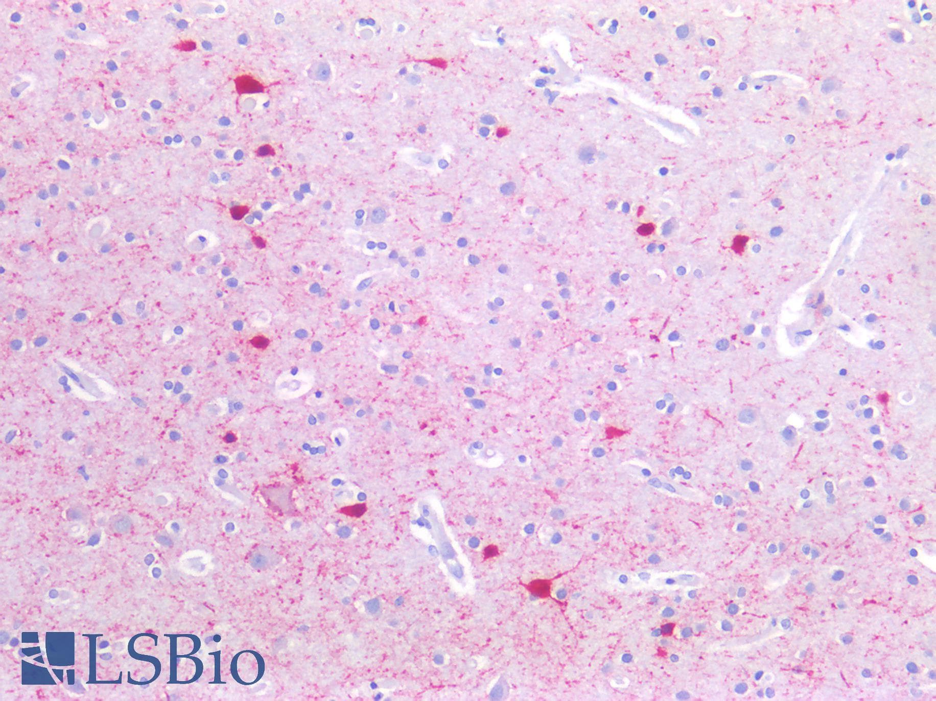 PathPlus™ SLC6A8 Antibody (aa359-408)