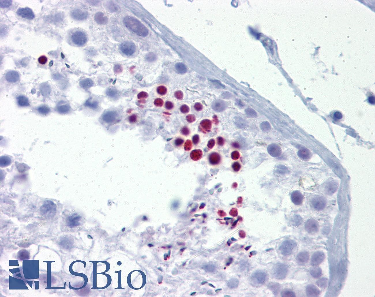 GRG4 / TLE4 Antibody (aa215-264)