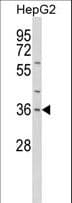 Polyclonal Rabbit anti-Human IL1A / IL-1 Alpha Antibody (aa177-206, IHC, WB)