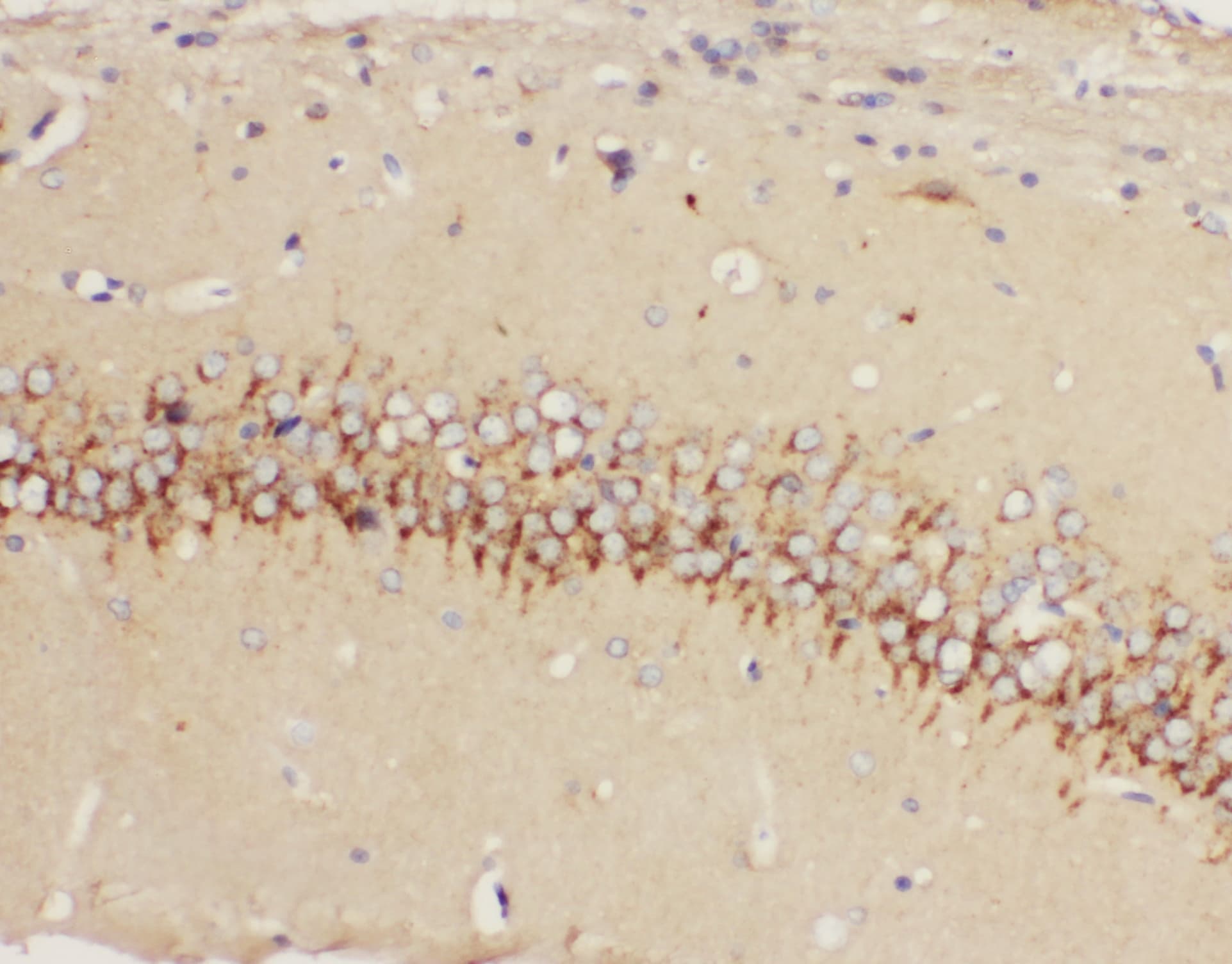 Polyclonal Rabbit anti-Human HTR1A / 5-HT1A Receptor Antibody (aa404-422, IHC, WB)