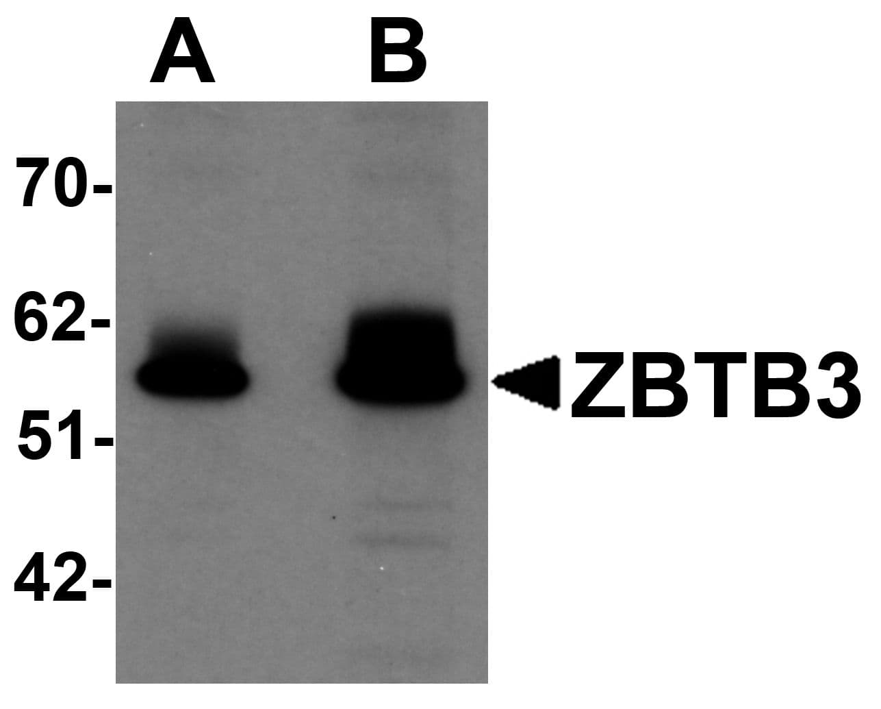 IHC-plus™ Polyclonal Rabbit anti-Human ZBTB3 Antibody (IHC, IF, WB)