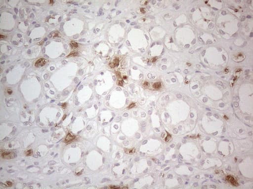NOBOX Antibody (aa1-271, clone OTI4C5)