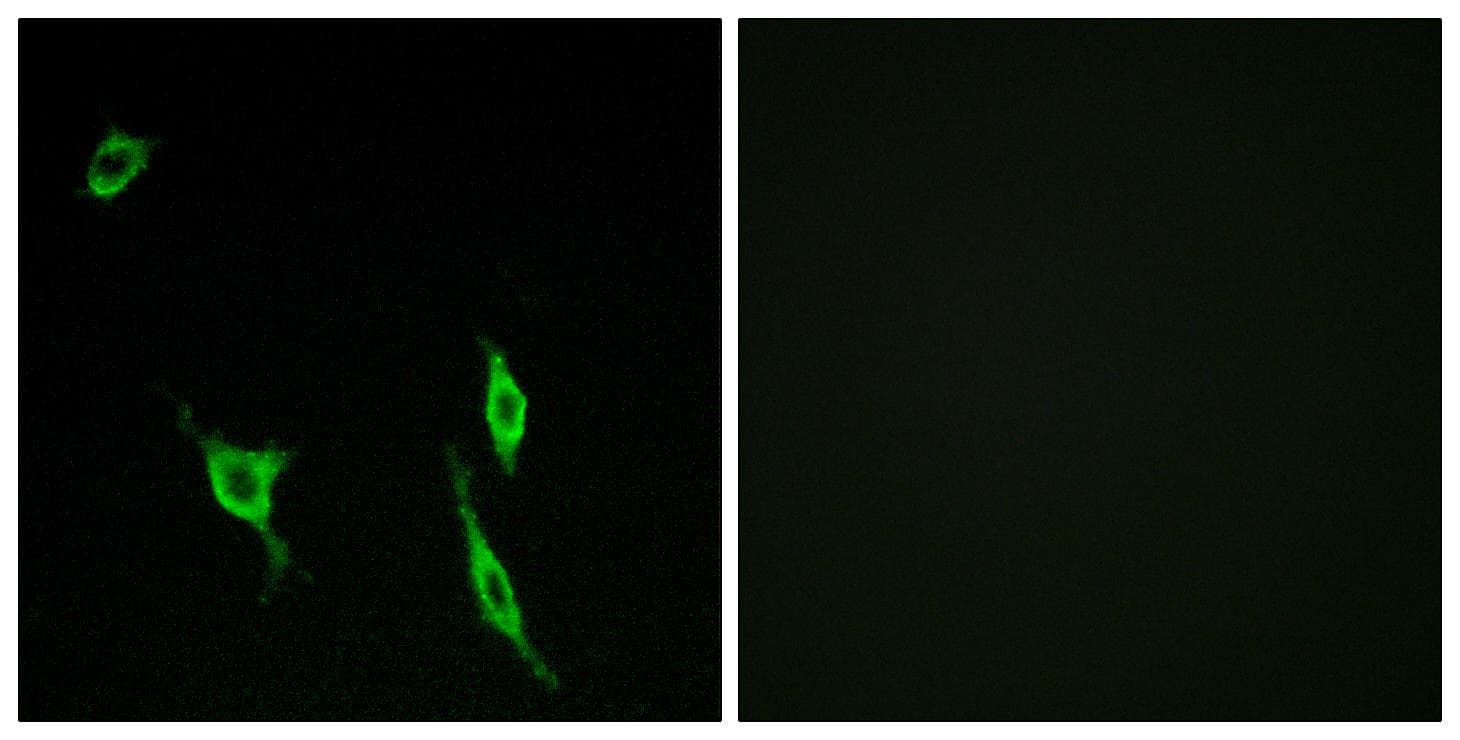 DCC Antibody