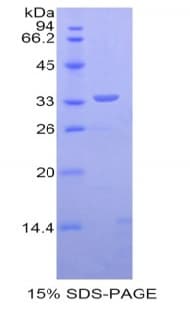 Human DMD / Dystrophin Protein (Recombinant His)