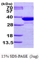Human ECH1 Protein (Recombinant His)