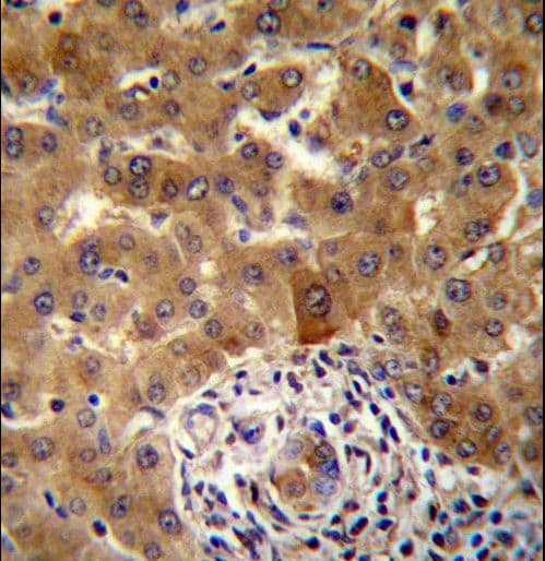 Polyclonal Rabbit anti-Human JADE1 / PHF17 Antibody (aa22-51, IHC, WB)