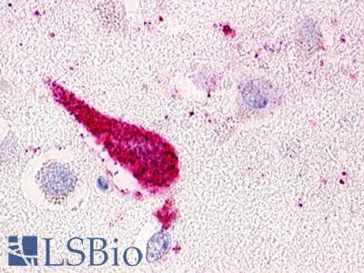 PathPlus™ GPRC5D Antibody (N-Terminus)