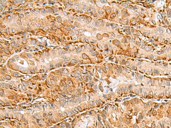 Polyclonal Rabbit anti-Human C3orf38 Antibody (IHC)