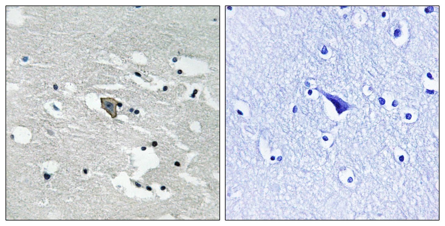 FLT1 / VEGFR1 Antibody (phospho-Tyr1048)