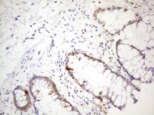 TNFSF5IP1 / CLAST3 Antibody (clone OTI1A1)
