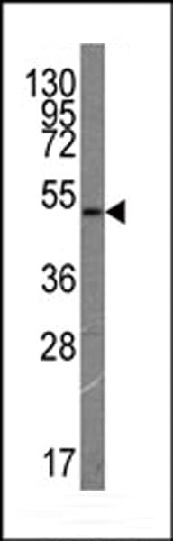 FLT4 / VEGFR3 Antibody (clone 44CT92.4.4)