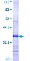 Human HYAL2 Protein (Recombinant GST, N-terminus)