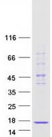 Human SNRPD2 Protein (Recombinant Myc-DDK (Flag))