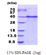 Human ING1 Protein (Recombinant His)