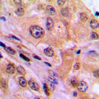 RELA / NFKB p65 Antibody (C-Terminus)