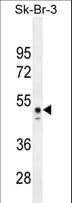 CNOT6L Antibody (aa414-442)