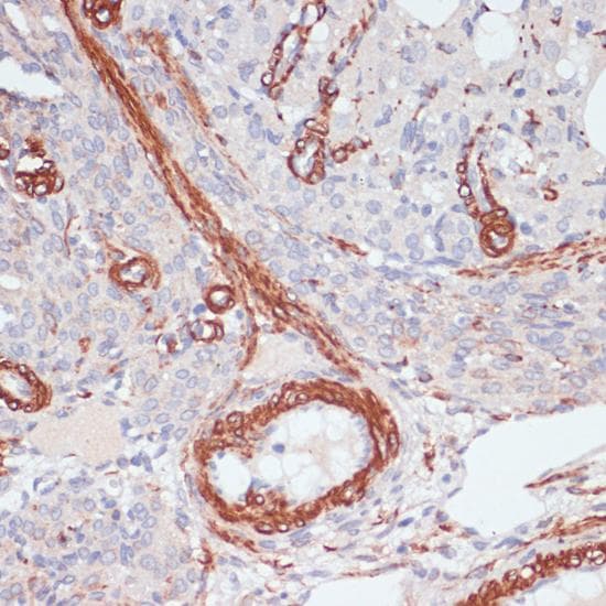 DES / Desmin Antibody