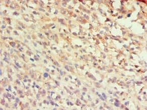 CCL25 / TECK Antibody (aa24-150)