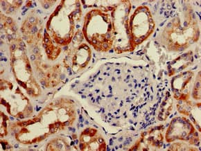 BAIAP2 / IRSP53 Antibody