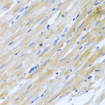 IHC-plus™ CCL17 / TARC Antibody