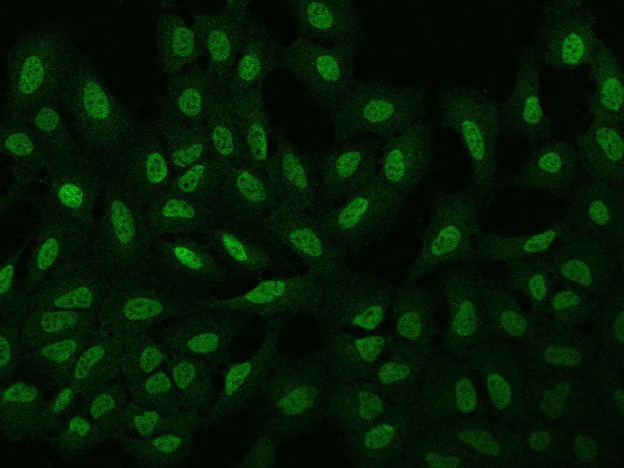 ARHGAP22 / RhoGAP2 Antibody