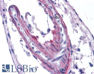 PathPlus™ Polyclonal Rabbit anti-Human APLNR/ Apelin Receptor / APJ Antibody (Extracellular Domain, IHC)