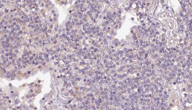 RHOE / RND3 Antibody
