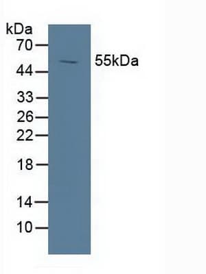 NR1H3 / LXR Alpha Antibody (aa95-434)
