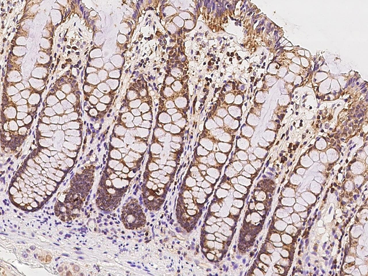 ICT1 / DS1 Antibody