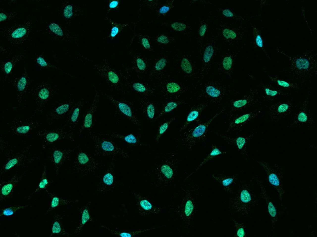 CBX1 / HP1 Beta Antibody