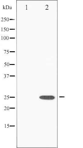 EIF4E Antibody (phospho-Ser209)