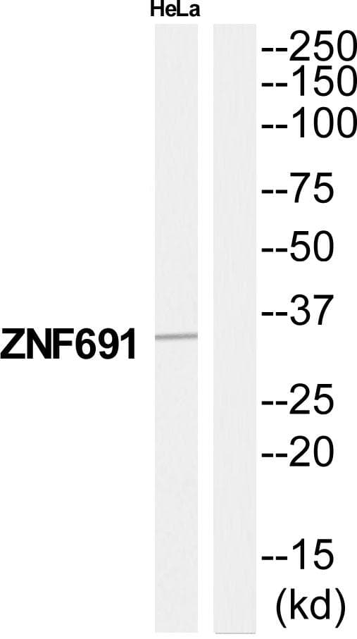 Polyclonal Rabbit anti-Human ZNF691 Antibody (WB)