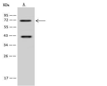 ACOX3 Antibody
