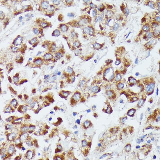Polyclonal Rabbit anti-Human DUT / DUTPase Antibody (IHC, IF, WB)
