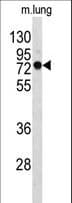 Polyclonal Rabbit anti-Human EEFSEC / EFSEC Antibody (aa541-568, IHC, WB)