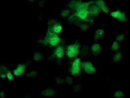 PSMB4 Antibody (clone OTI5B5)