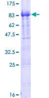 Human PIKFYVE / PIP5K Protein (Recombinant GST)