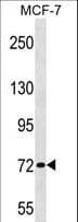 Polyclonal Rabbit anti-Human ZNF408 / PRDM17 Antibody (aa223-251, WB)
