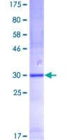 Human SPINK1 Protein (Recombinant GST)