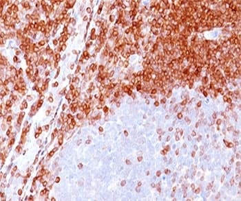 IHC-plus™ BCL2 / Bcl-2 Antibody (clone 100/D5, Azide-free, BSA-free)