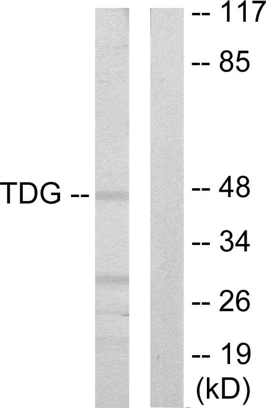 TDG / Thymine DNA Glycosylase Antibody